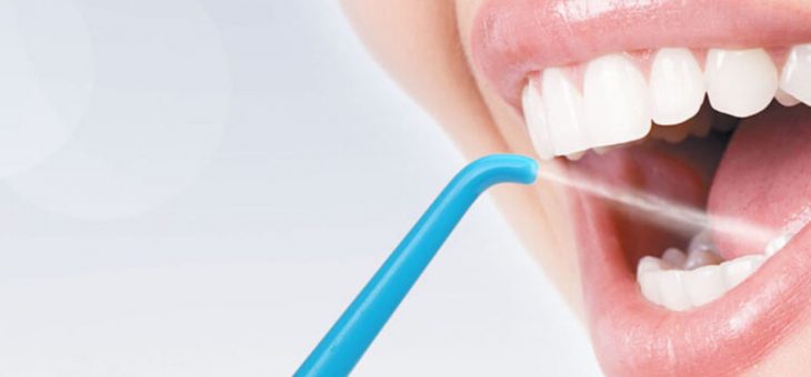 Jet dentaire : utile pour l’entretien des dents ?